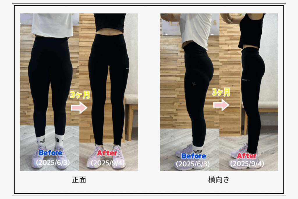 ピラティスを3ヶ月続けた女性の脚のビフォーアフター