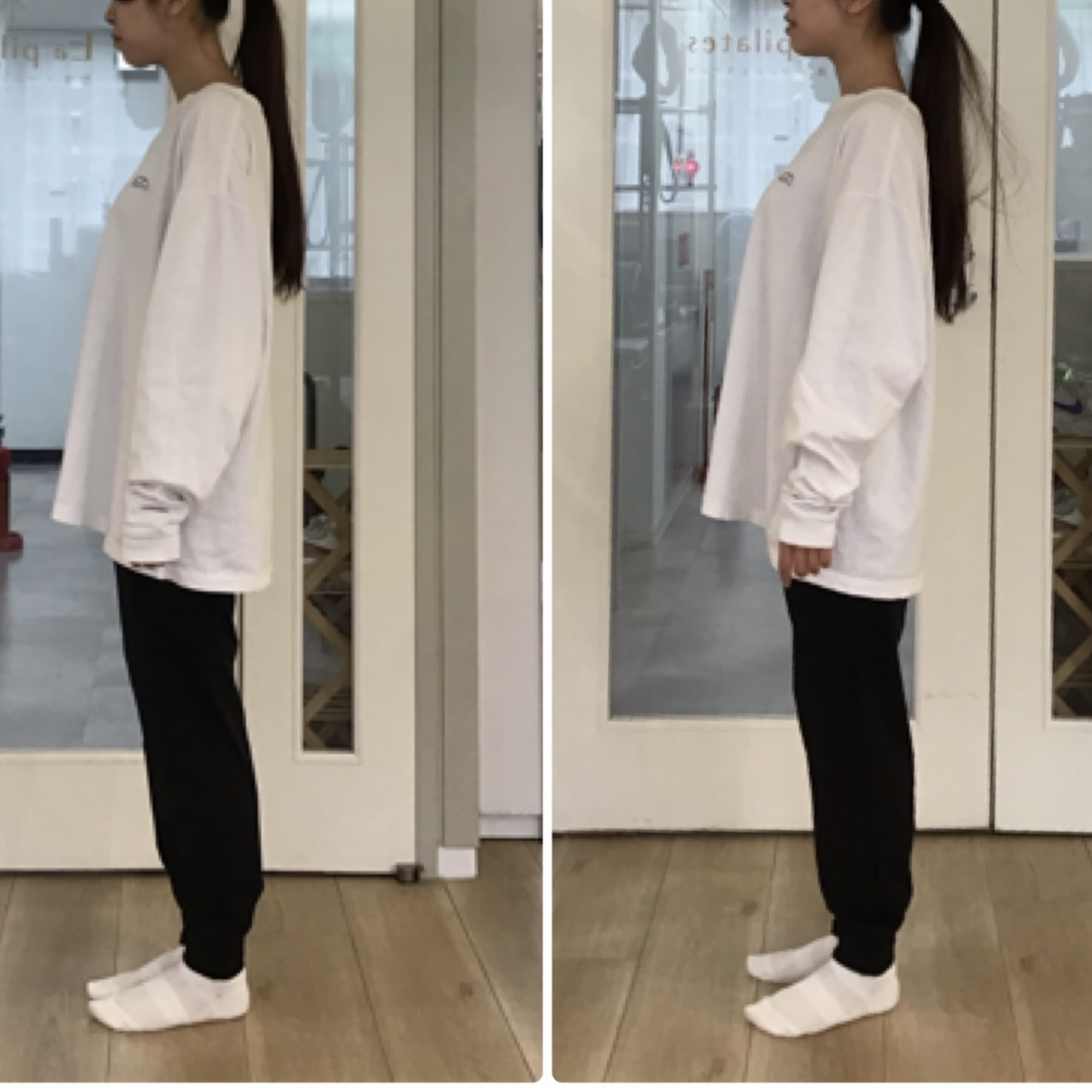 La pilates体験レッスン一回での姿勢の変化(ストレートネック改善)